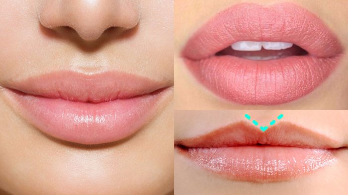 Trend Kecantikan Filler Bibir yang Semakin Populer