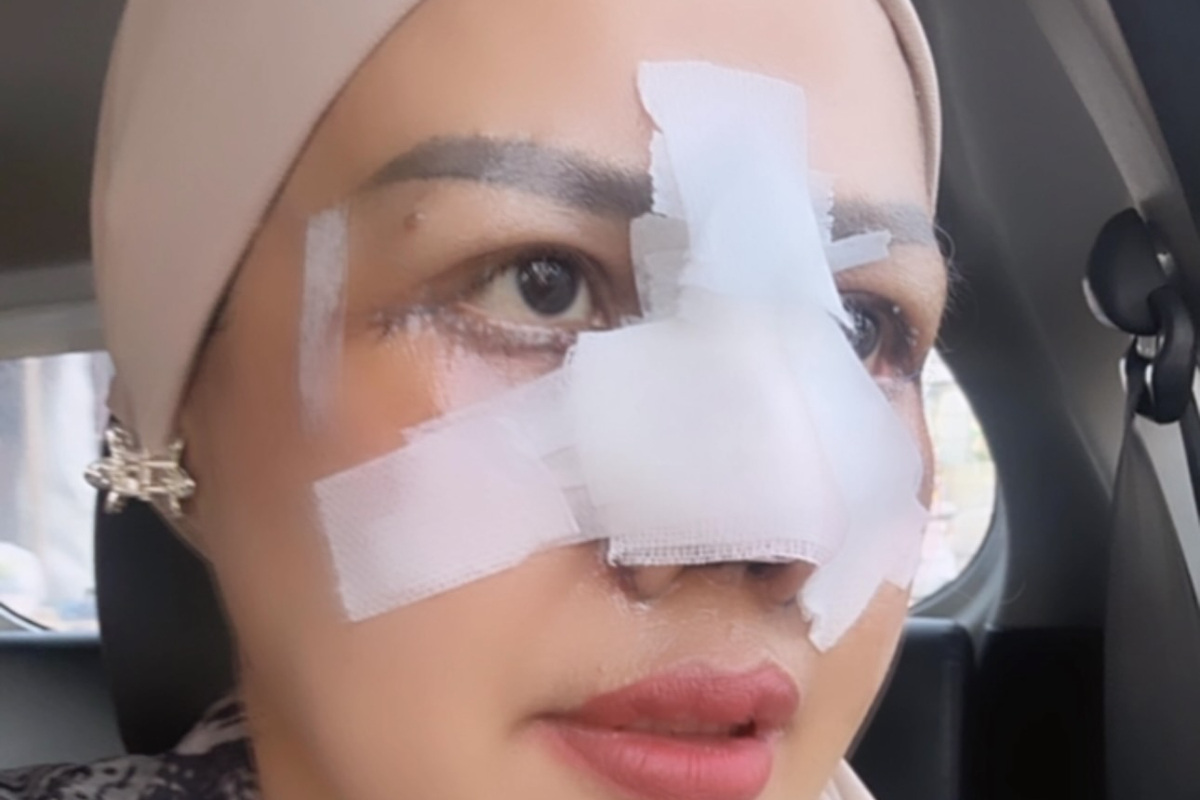 Elly sugigi oplas: Elly Sugigi Jalani Oplas Hidung dan Mata,…